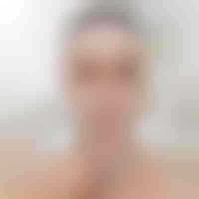 Bantë ngritëse për formësimin e fytyrës | KIMLIFT